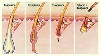 Alopecia_Calvicie_infor[1]