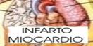 INFARTOICO